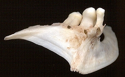 pharyngeal teeth