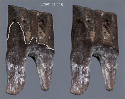 Molar of Mexican packrat showing dentine tracts