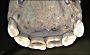 thumbnail of lower incisors of a horse
