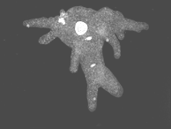 image of amoeba