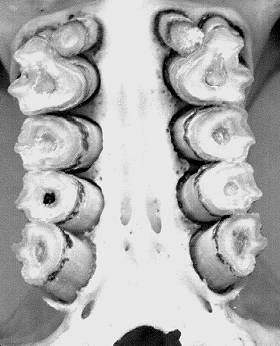 teeth, occlusal view