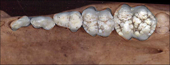 Pig teeth, showing bunodont dentition
