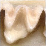 Dilambdodont tooth