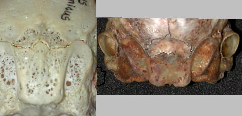 Comparison of Lepus and Sylvilagus interparietals