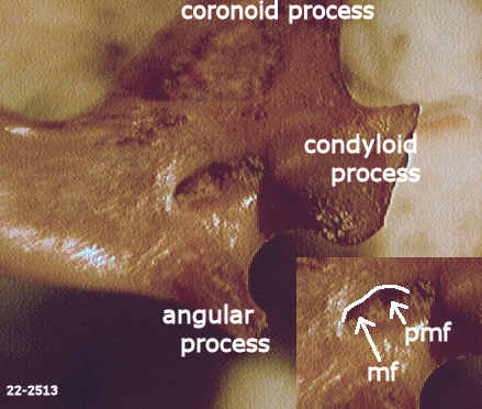 Fossil Sorex merriami dentary showing the postmandibular foramen and mandibular foramen
