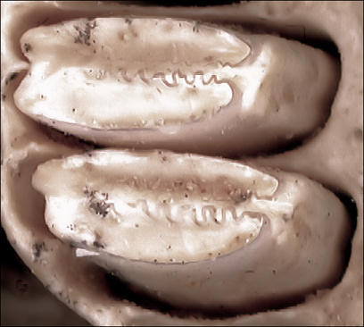 first and second upper right molars of Sylvilagus